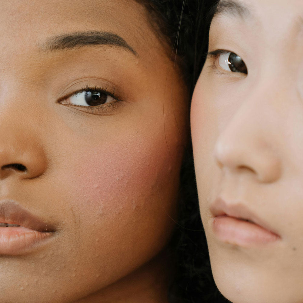 Comment déterminer ton type de peau ?